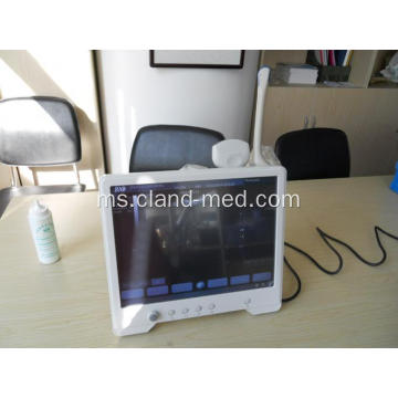 Harga Mesin Ultrasound Pengimbas Ultrasound Portable